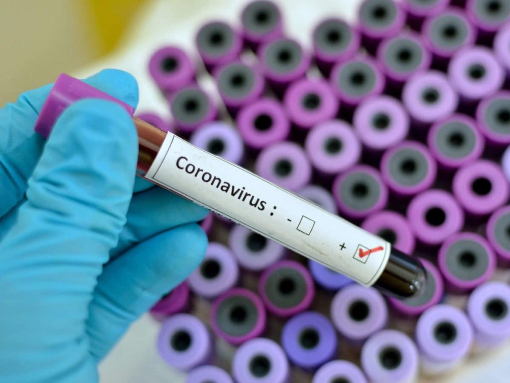 Чем опасен коронавирус